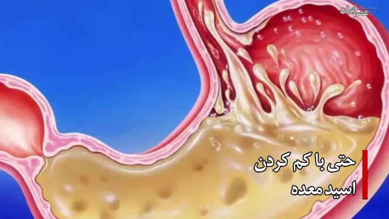 ببینید؛ خواص وممنوعیت های رزماری؛ چیزهایی که درباره این گیاه نمی‌دانید