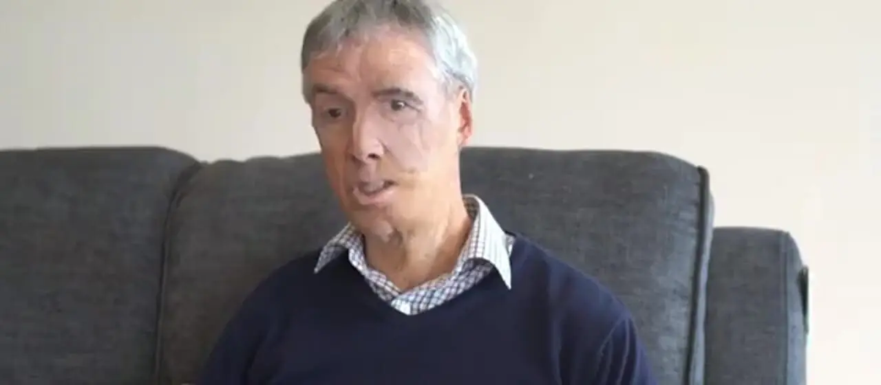 بازسازی صورت مردی ۷۵ ساله با فناوری چاپ سهبعدی پس از سانحه تصادف