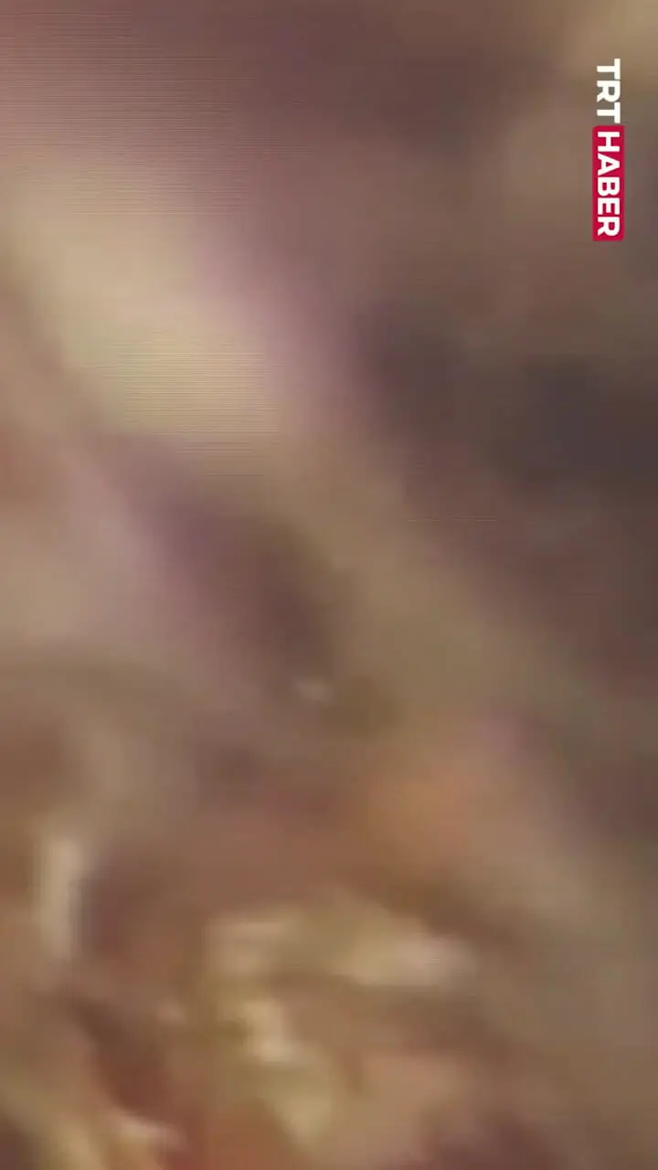 پروانه زنده از گوش مرد ۴۰ ساله خارج شد