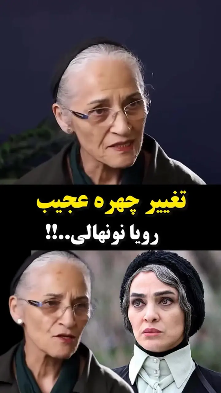 ماجرای تغییر چهره «رویا نونهالی» چیست؟